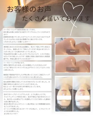 肌育ピーリング 🫧megumiのエステ・リラクイメージ