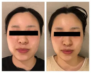 自由が丘📍 Belrougeのエステ・リラクイメージ