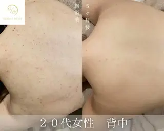 Grandir所属・ハーブピーリング専門 グランディール　武内のエステ・リラクイメージ