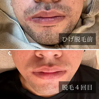 メンズ 脱毛サロン Arumのエステ・リラクイメージ