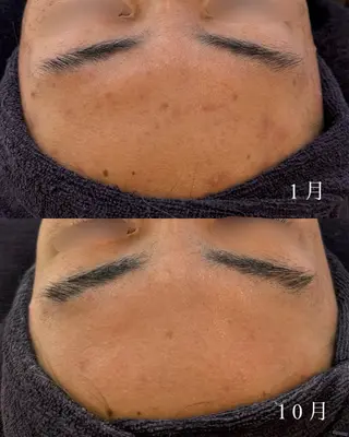 yukiko/美容師 ニキビ特化/肌質改善のエステ・リラクイメージ