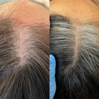 毛穴専門店MeMe.八千代店所属・毛穴・頭皮 専門店💪のその他イメージ