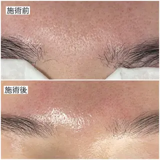 毛穴専門サロン MUKUムクのエステ・リラクイメージ