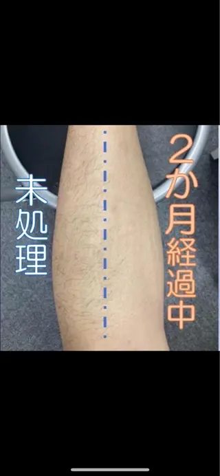 メンズ ecia 脱毛/豊田/浄水のエステ・リラクイメージ