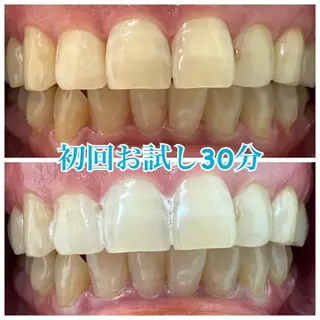 ホワイトニング🦷 ネイル💅LEAのその他イメージ