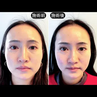 渋谷 小顔美容鍼 専門サロン YZのエステ・リラクイメージ