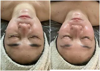 ize 横浜店のエステ・リラクイメージ