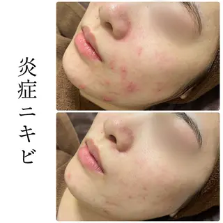 ハーブピーリング専門 BIOEL横浜のエステ・リラクイメージ