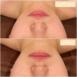 立体小顔×艶肌×美ボ ディ似合わせ施術 岡のエステ・リラクイメージ