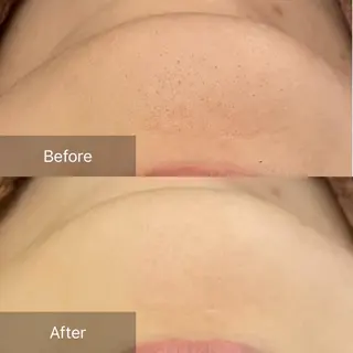 毛穴/毛穴洗浄専門 エミルカ船橋のエステ・リラクイメージ