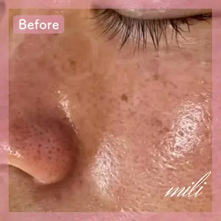 【毛穴ケア専門店✨】 mili 須藤歩華のエステ・リラクイメージ
