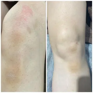 脱毛&美容サロン BLUESEAのエステ・リラクイメージ