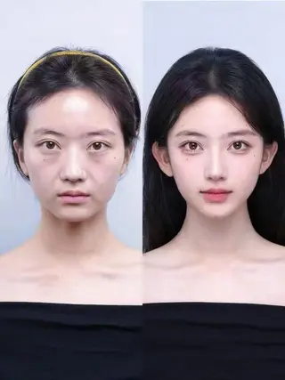 ネイル aliaハイフ&水光ジェットサロン所属・aliaハーブ水光店 エステティシャン募集のエステ・リラクイメージ