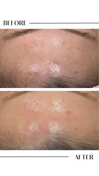 フェイシャル/脱毛 ジョアアンジェ竹田のエステ・リラクイメージ