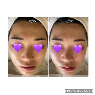 COCO beautyサロンのエステ・リラクイメージ