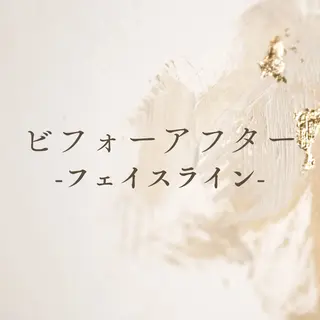 LiLL by Andre beauty所属・LiLL 熊本のエステ・リラクイメージ