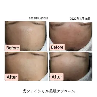 脇山 千佳のエステ・リラクイメージ