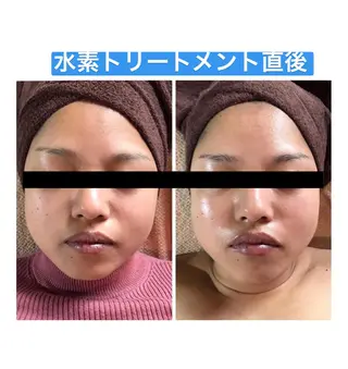 代表 MOMOのエステ・リラクイメージ