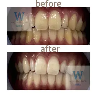 ホワイトニング ショップ船橋2号店のエステ・リラクイメージ