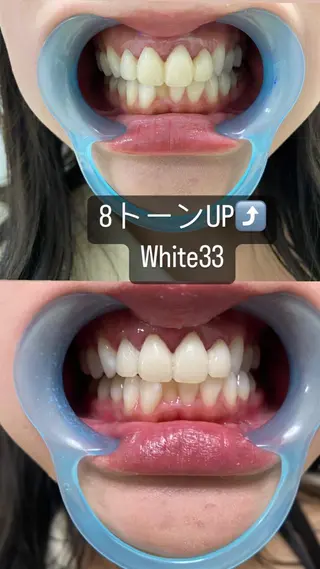 メンズ セルフホワイトニング White33大名のその他イメージ