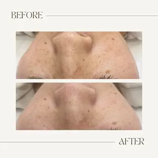 CEsalonEgg 齋藤のエステ・リラクイメージ