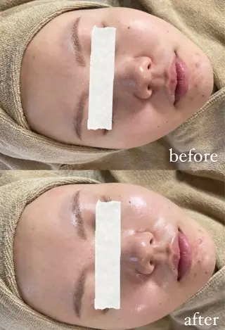 エステサロン Mi-mi.iのエステ・リラクイメージ