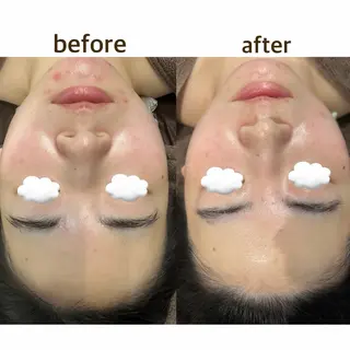 田辺🌿毛穴ケア サロンリテルナのエステ・リラクイメージ