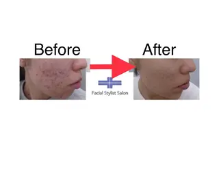 メンズ 肌質改善専門 鈴木悠のエステ・リラクイメージ