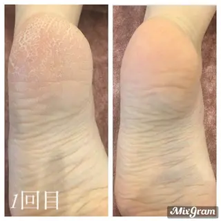 サロン potpourriのエステ・リラクイメージ