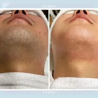 脱毛&シェービング 専門店　平岡のエステ・リラクイメージ