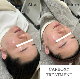 lafleur Yurinaのエステ・リラクイメージ