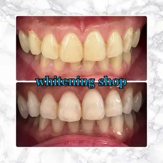 ホワイトニング ショップ津店のその他イメージ