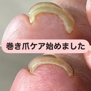 ネイル 深爪育成専門nail _Lumièlatのネイルデザイン