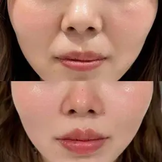 マツエク・マツパ 愛維美水光美肌専門店 メンズレディースokのエステ・リラクイメージ