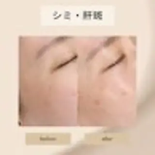 hue.所属・吉田 hue.のエステ・リラクイメージ