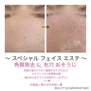 ビューティー ミロワールのエステ・リラクイメージ