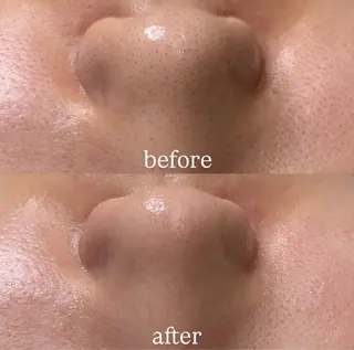 レアエイト所属・lea'8 lea'8のエステ・リラクイメージ