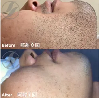 メンズ MEN‘S CARE メンズ脱毛サロンのエステ・リラクイメージ