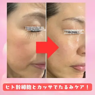 よもぎ蒸しサロン ゆんのエステ・リラクイメージ