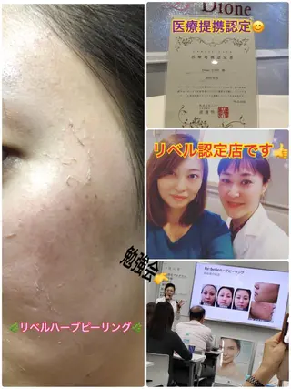 Dione 立川店のエステ・リラクイメージ
