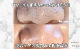 【毛穴&腸もみ】 salon kiwaのエステ・リラクイメージ