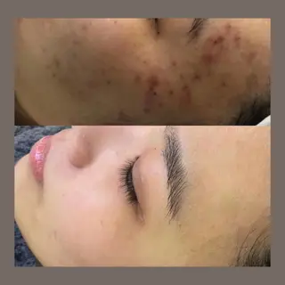 愛維美水光美肌専門店所属・愛維美水光美肌専門店 メンズレディースokのエステ・リラクイメージ