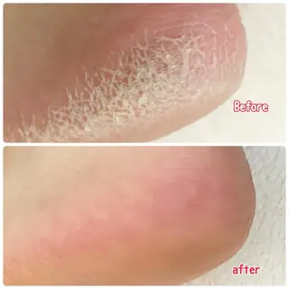 ネイル Lotus Nailのネイルデザイン