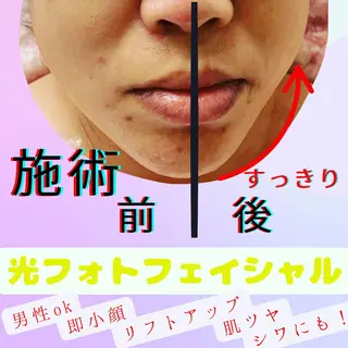 LUMINAルミナ 【肌管理サロン】のその他イメージ
