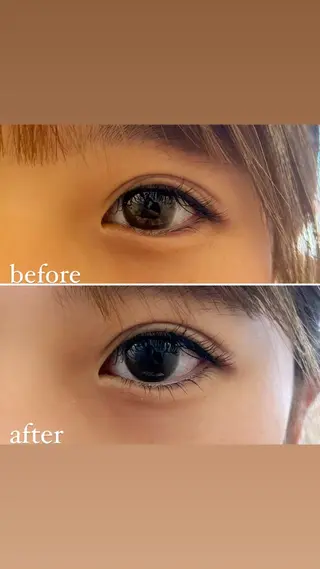 マツエク・マツパ fameu YURIのその他イメージ