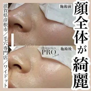 Ydot. 池内 友架のエステ・リラクイメージ