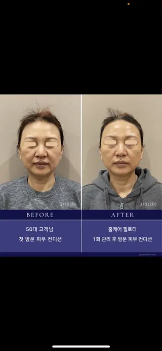 Monreve所属・美人スイッチdiet スーパージェクションのその他イメージ