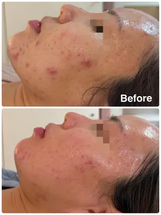 NICORI所属・NICORI大宮 (看護師)塩野飛のエステ・リラクイメージ