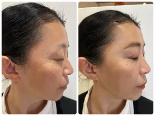 POLA The Beauty印場店のエステ・リラクイメージ