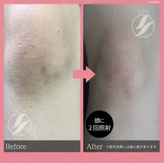 esperanza エスペランサのその他イメージ